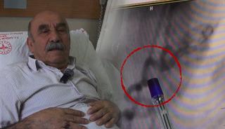 G&ouml;ğ&uuml;s yanması sandı, kan '&ccedil;alan' damar bulundu!