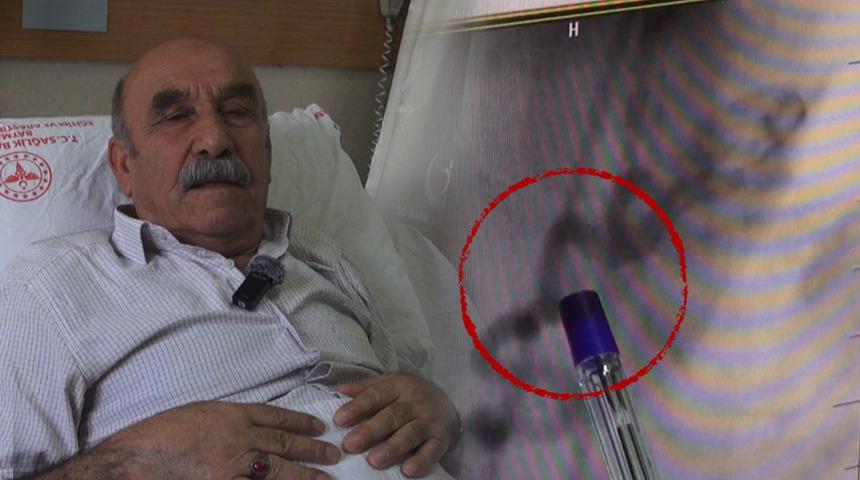 G&ouml;ğ&uuml;s yanması sandı, kalbinden kan '&ccedil;alan' damar bulundu!