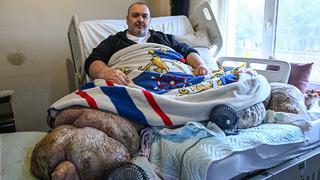 300 kiloya ulaşan fil hastası sevk edildi: Kapılar kırıldı, özel ekiple Ankara'ya gönderildi