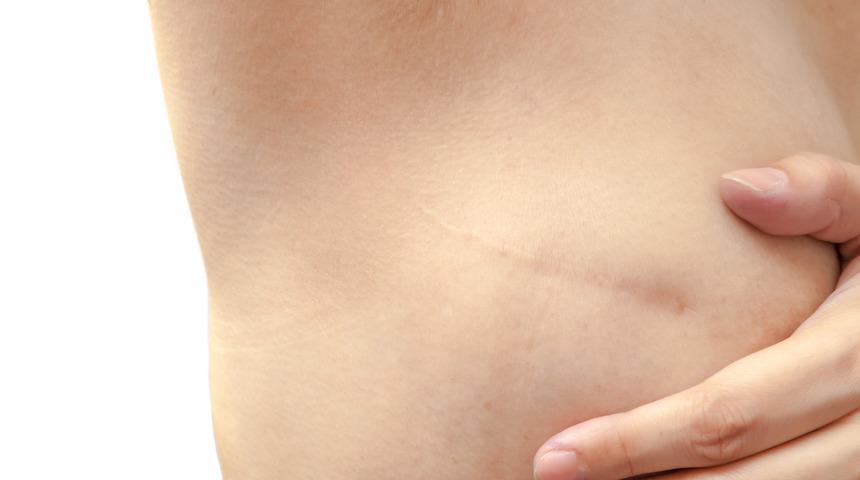 Meme onarımıyla yeni başlangı&ccedil;lar! 