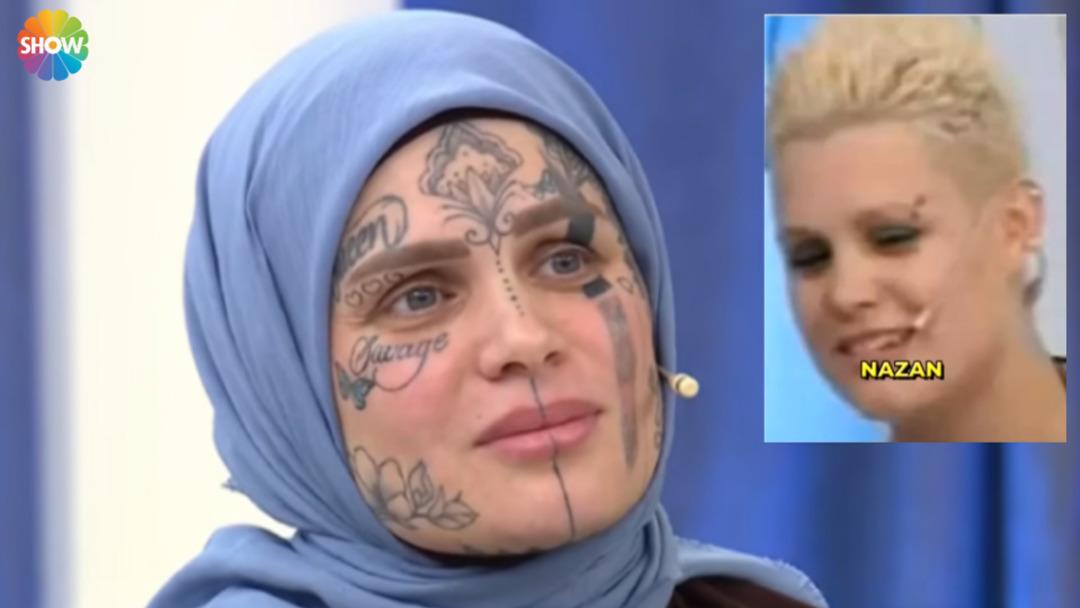 Y&uuml;z&uuml;ndeki d&ouml;vmelerle g&uuml;ndem olan Nazan &Uuml;nal ın baş&ouml;rt&uuml;s&uuml;z hali ortaya &ccedil;ıktı! Evlilik programına da katılmış  3