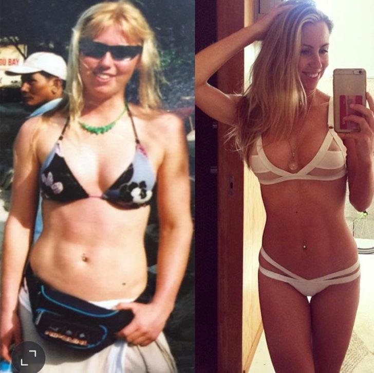 Günde 20 muz yiyerek bu hale geldi G3