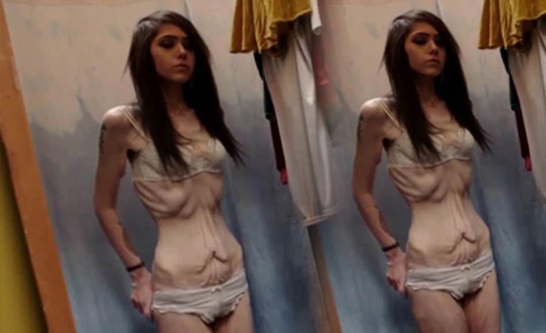 Kendisini kontrol edemedi! Kilo vermek isterken bu hale geldi