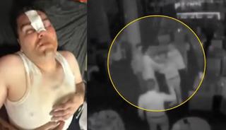 13 Bin 500 liralık &ccedil;erez kavgası! Hesap gitti, dayak geldi