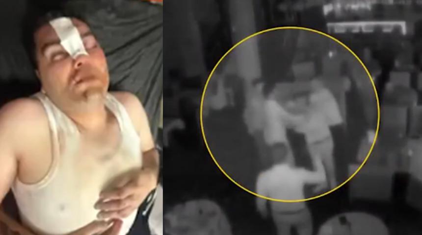 13 Bin 500 liralık &ccedil;erez kavgası! Hesap gitti, dayak geldi