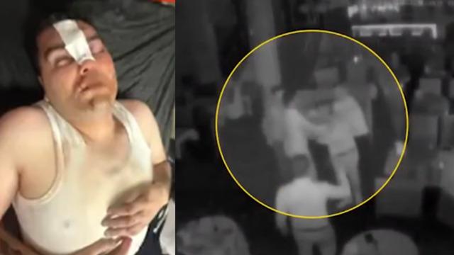 13 Bin 500 liralık çerez kavgası! Hesap gitti, dayak geldi