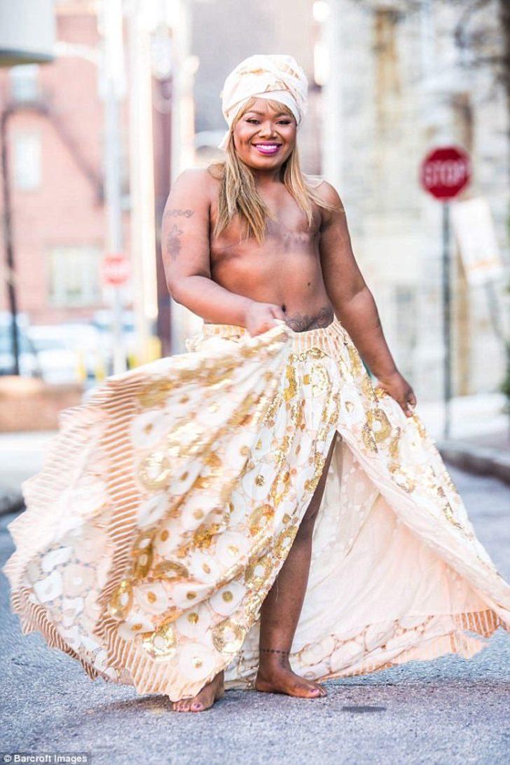 Meme kanseriyle mücadele eden insanlara moral oluyor G1