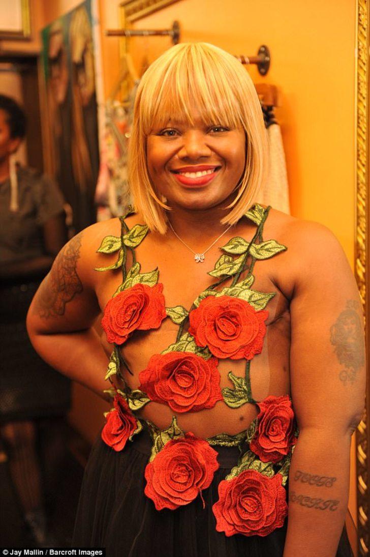 Meme kanseriyle mücadele eden insanlara moral oluyor G2