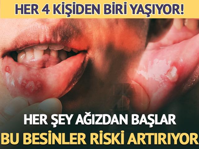 Bu besinler ağız yaralarına neden oluyor! 