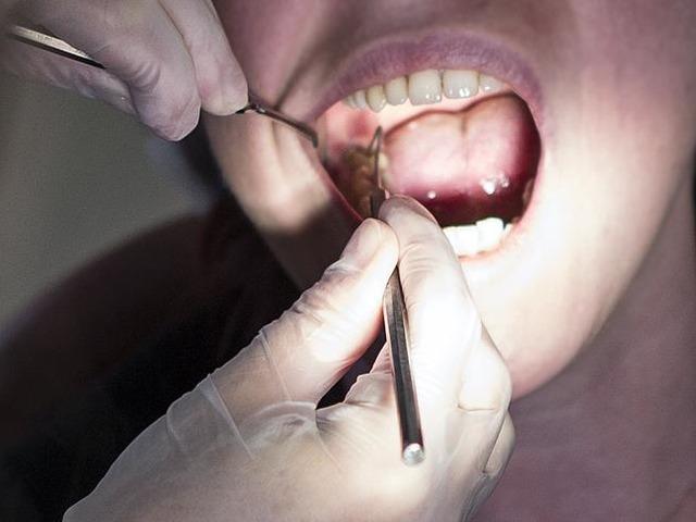 &lsquo;Diş eti hastalıkları kalp ve damar sağlığını olumsuz etkiliyor&rsquo;
