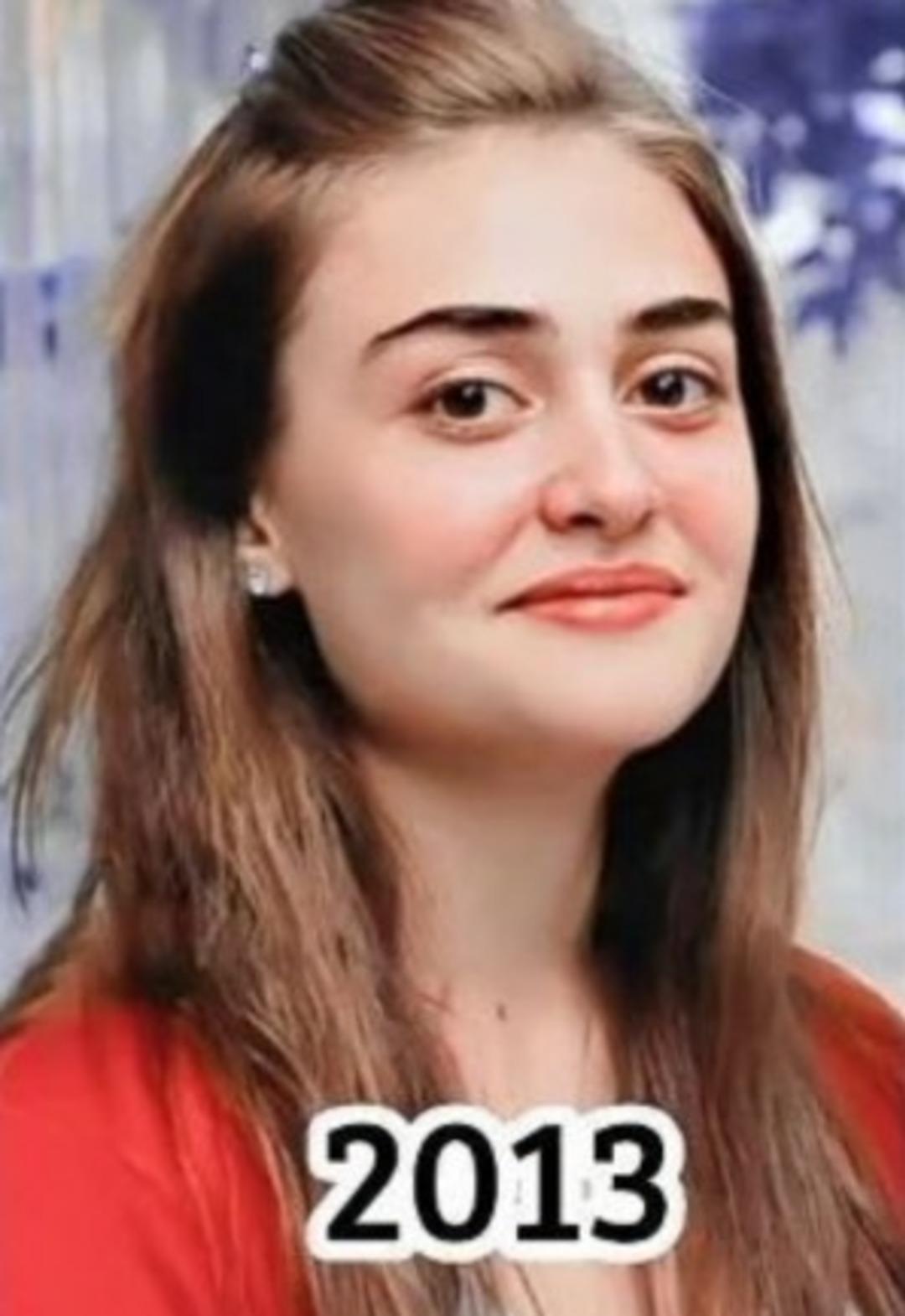 Esra Bilgi&ccedil; in yıllar &ouml;nceki hali ortaya &ccedil;ıktı! Değişimi şaşırttı 4