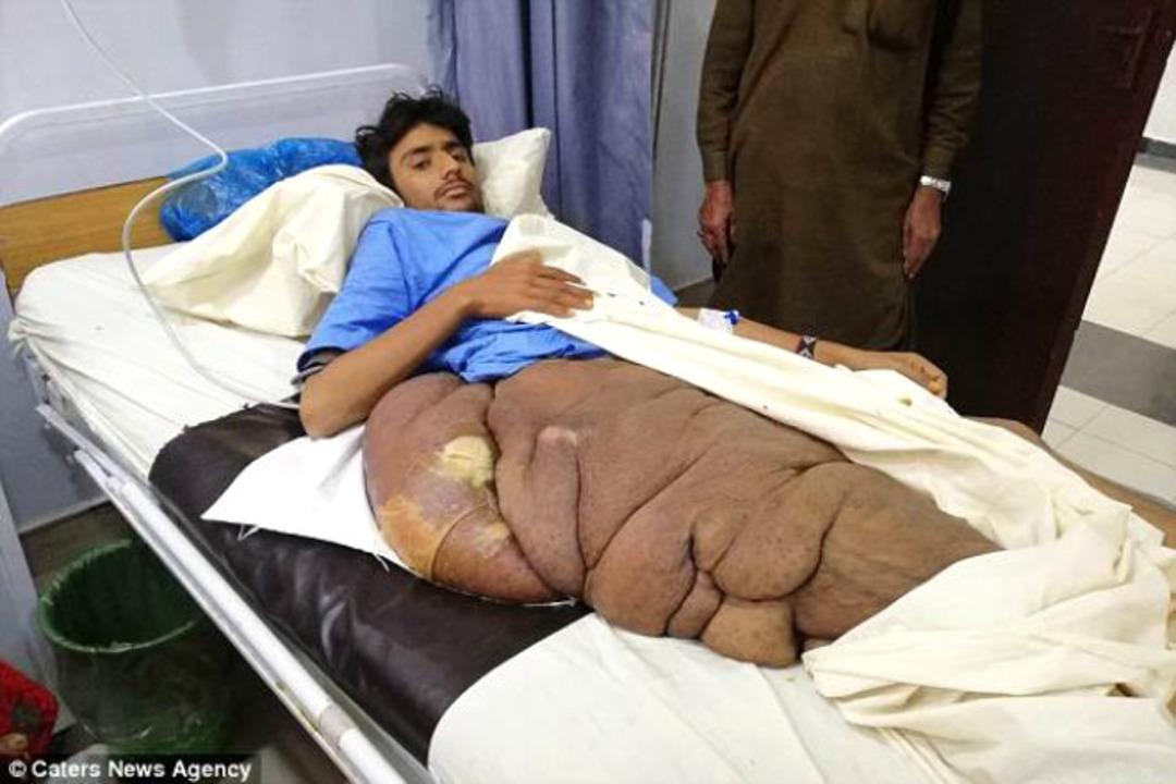 V&uuml;cudundaki dev t&uuml;m&ouml;r onu bu hale getirdi