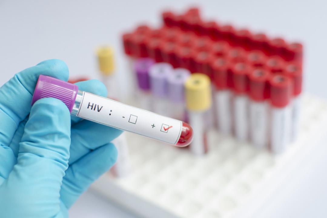 HIV pozitif olduğunu evlilik arifesindeki eşinden gizledi: Mahkemeden dikkat &ccedil;eken karar 1