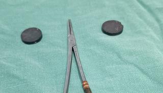 4 yaşındaki &ccedil;ocuğun bağırsaklarından &ccedil;ıkana inanamayacaksınız