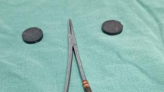 Çekilen röntgen filmi herkesi şaşırttı! 4 yaşındaki çocuğun bağırsaklarından çıkana inanamayacaksınız