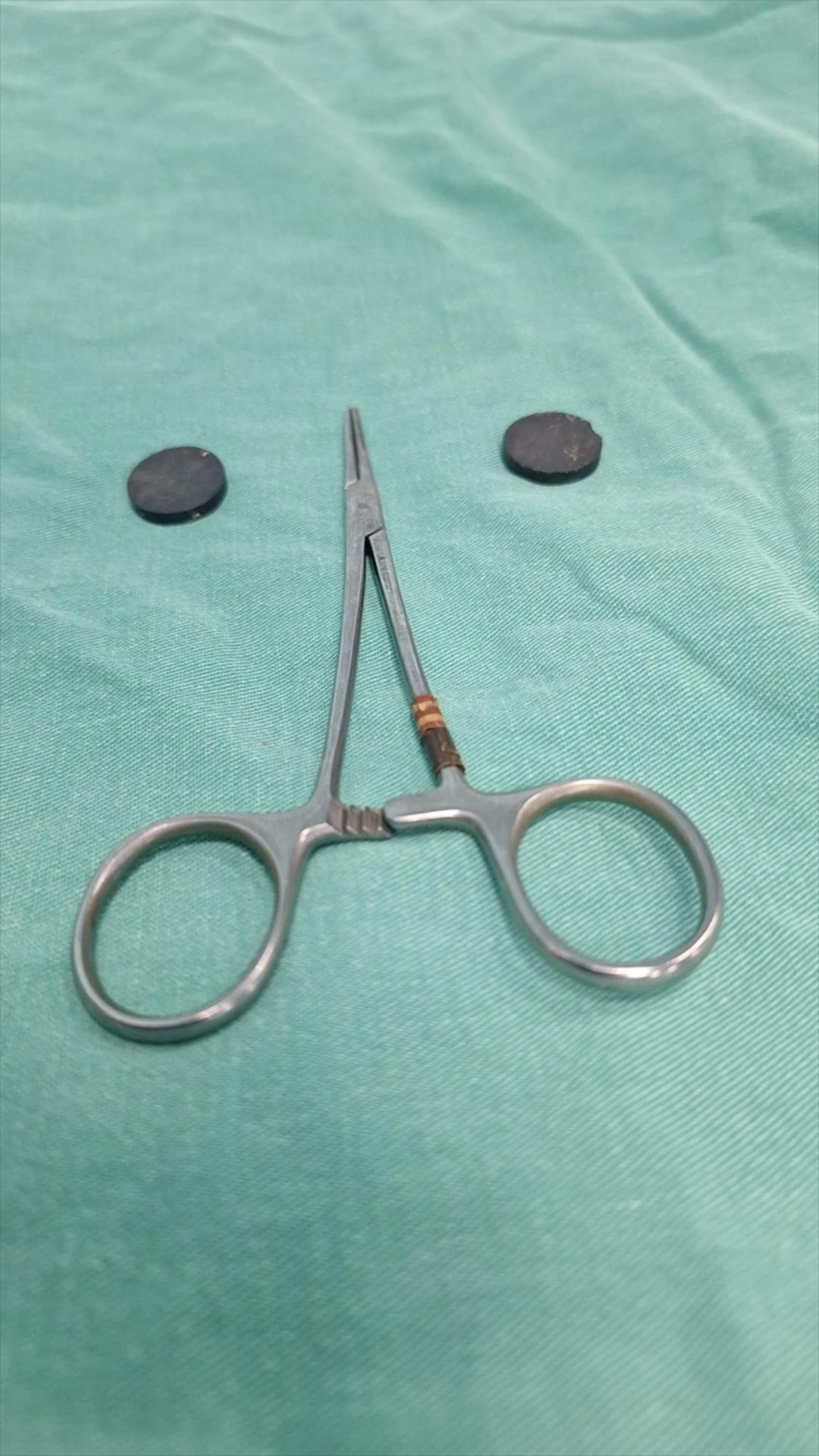 Çekilen röntgen filmi herkesi şaşırttı! 4 yaşındaki çocuğun bağırsaklarından çıkana inanamayacaksınız 1