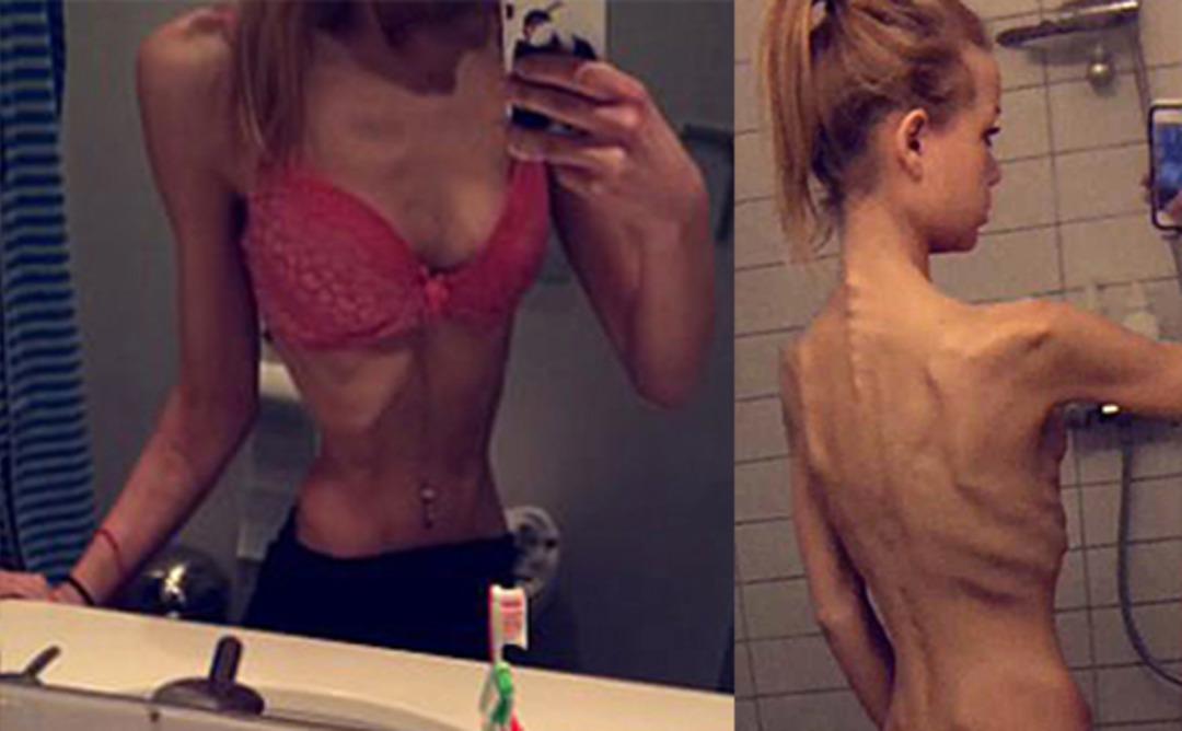 Yaşlı adamın tacizine uğradı, bir deri bir kemik kaldı