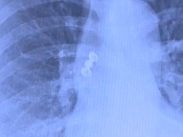 Sabah uyandı, dişleri yoktu! Doktorlar şok oldu