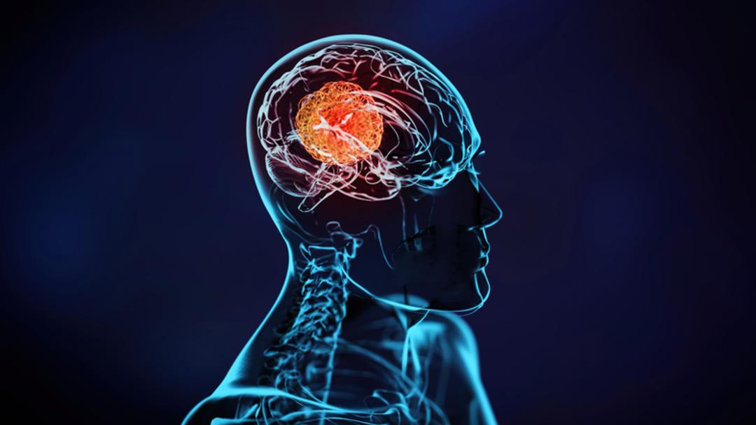 Ormanda ka&ccedil; kaplan g&ouml;r&uuml;yorsunuz? 100 Kişiden 99&rsquo;u yanlış cevap veriyor 3