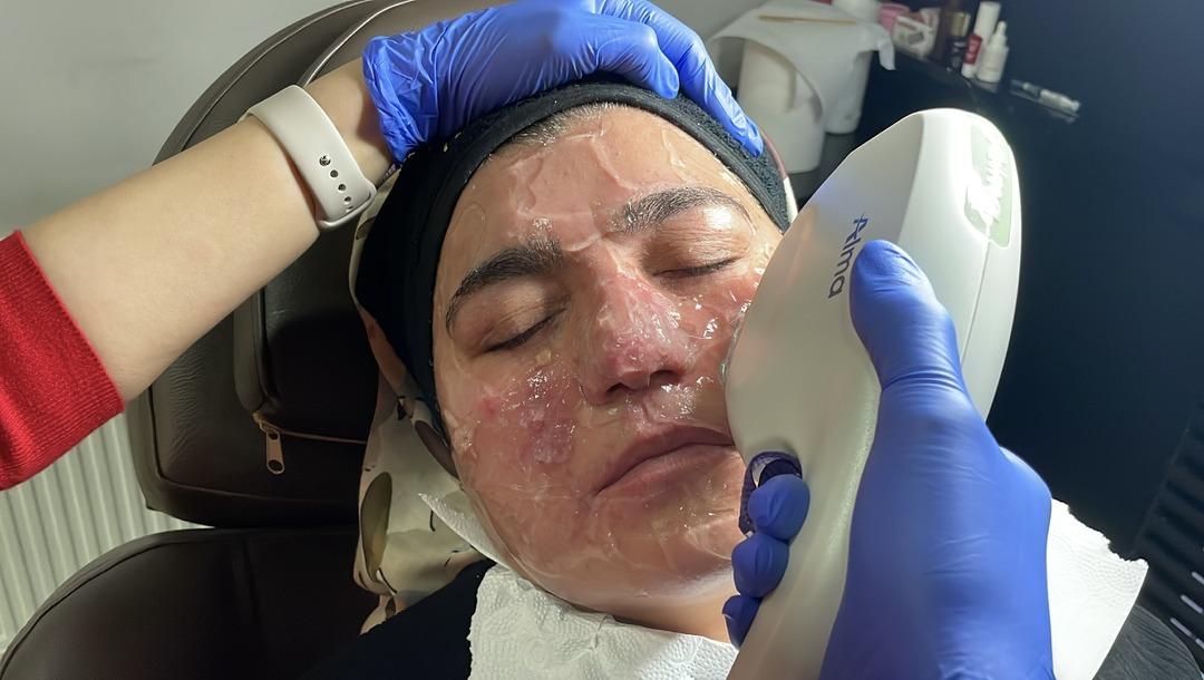 Yıllarca evden çıkmadı: Oğlunun düğününe bile gidemedi! Tedaviyle hayatı değişti 2