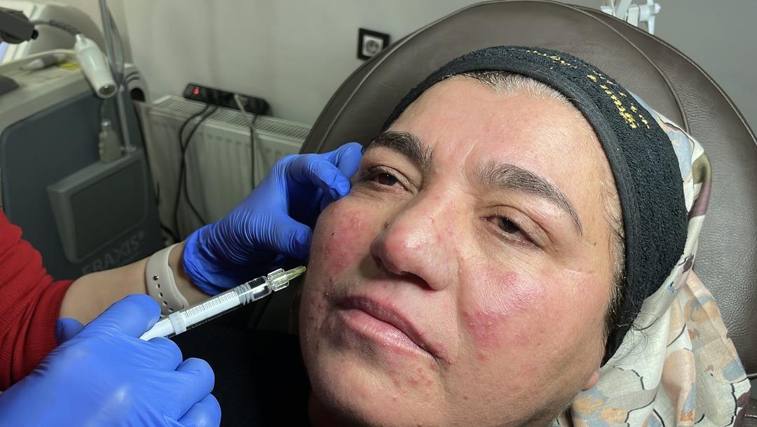 Yıllarca evden çıkmadı: Oğlunun düğününe bile gidemedi! Tedaviyle hayatı değişti 4