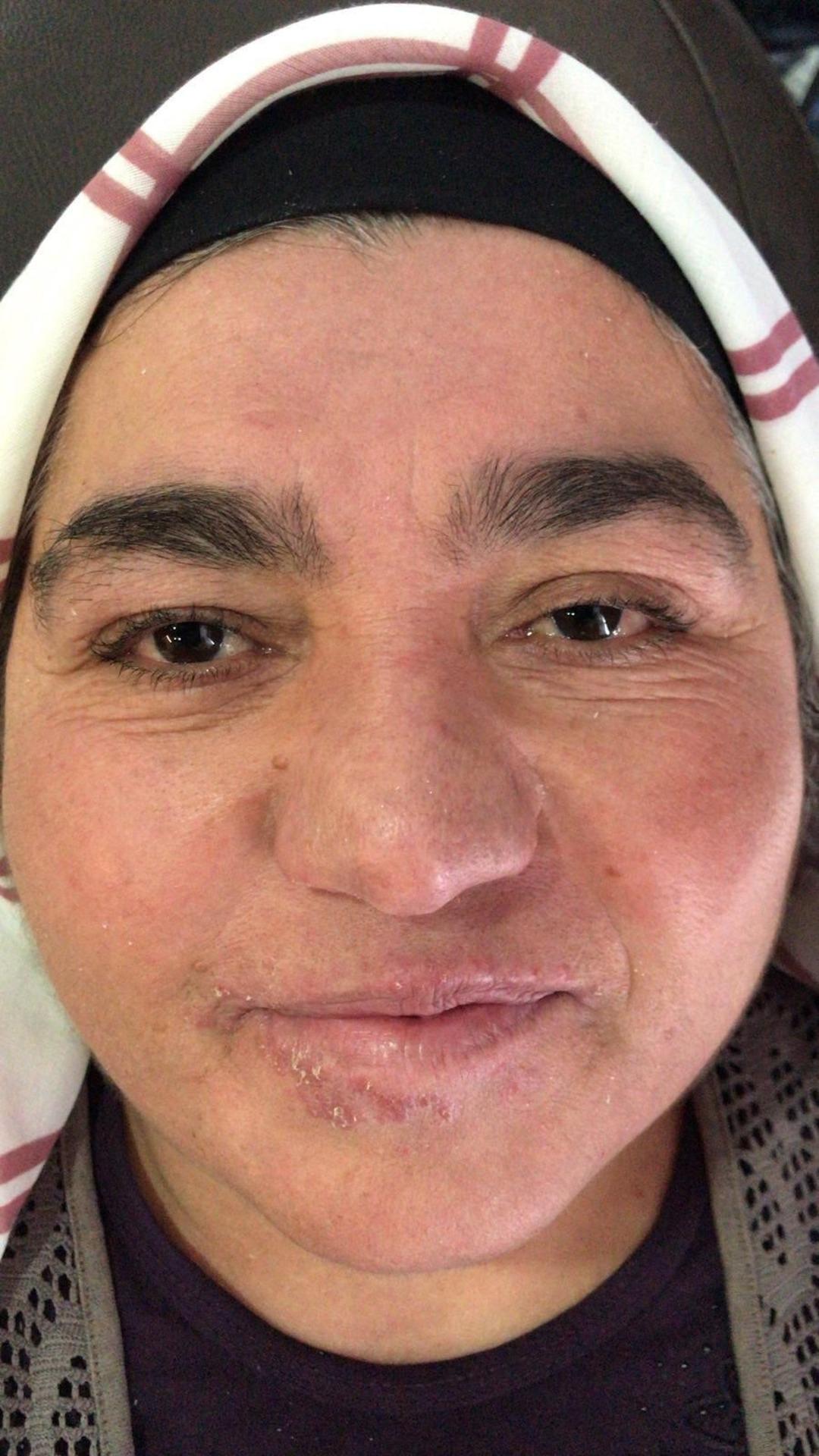 Yıllarca evden çıkmadı: Oğlunun düğününe bile gidemedi! Tedaviyle hayatı değişti 6