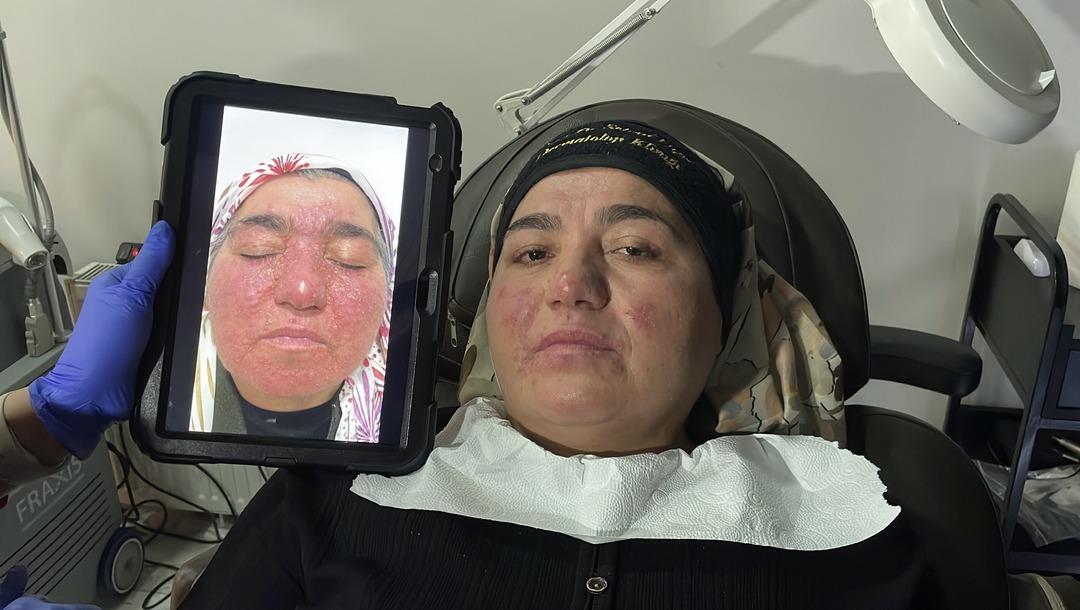 Yıllarca evden çıkmadı: Oğlunun düğününe bile gidemedi! Tedaviyle hayatı değişti 7