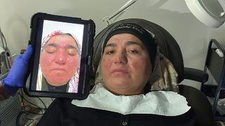 Yıllarca evden çıkmadı: Oğlunun düğününe bile gidemedi! Tedaviyle hayatı değişti