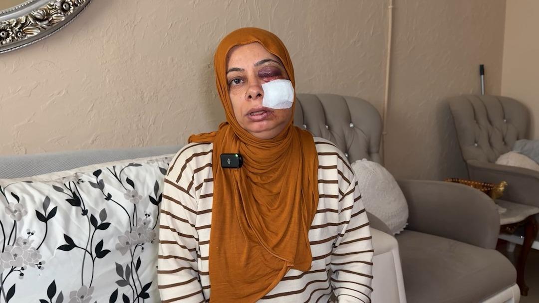 Elektrikli bisikletle r&ouml;gara d&uuml;şt&uuml;! Tanınmayacak hale geldi 1