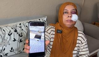 Elektrikli bisikletle r&ouml;gara d&uuml;şt&uuml;! Tanınmayacak hale geldi