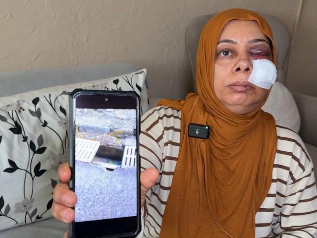 Elektrikli bisikletle r&ouml;gara d&uuml;şt&uuml;! Tanınmayacak hale geldi