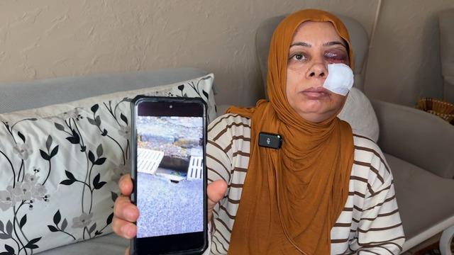 Elektrikli bisikletle rögara düştü! Tanınmayacak hale geldi