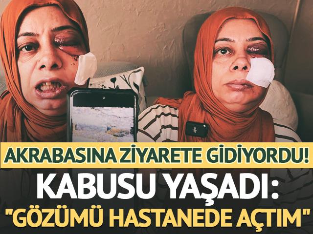 Elektrikli bisikletle r&ouml;gara d&uuml;şt&uuml;! Tanınmayacak hale geldi