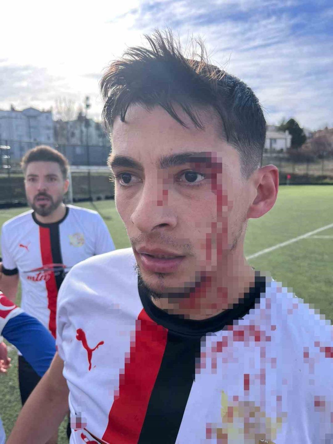 B&ouml;yle ma&ccedil; g&ouml;r&uuml;lmedi! Son d&uuml;d&uuml;k &ccedil;aldı saha i&ccedil;i savaş alanına d&ouml;nd&uuml;: 3 futbolcu hastanelik oldu 1