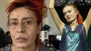 Son dakika: &Uuml;nl&uuml; şarkıcı Yıldız Tilbe rahatsızlandı! Hastane &ccedil;ıkışı g&ouml;r&uuml;nt&uuml;lendi