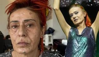 &Uuml;nl&uuml; şarkıcı Yıldız Tilbe rahatsızlandı! Hastane &ccedil;ıkışı g&ouml;r&uuml;nt&uuml;lendi