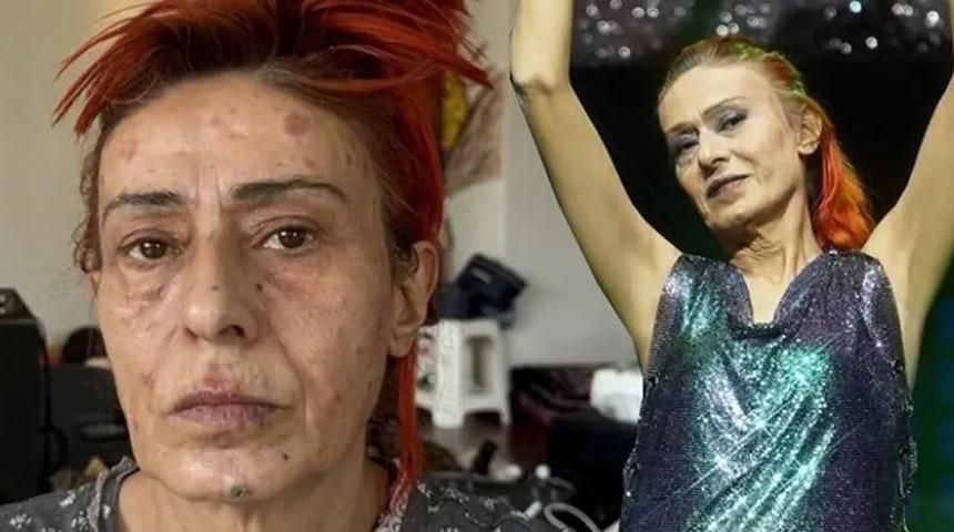 &Uuml;nl&uuml; şarkıcı Yıldız Tilbe rahatsızlandı! Hastane &ccedil;ıkışı g&ouml;r&uuml;nt&uuml;lendi