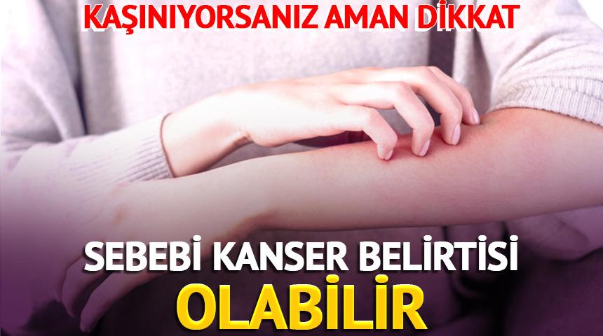 Kaşınıyorsanız aman dikkat: Sebebi kanser belirtisi olabilir!