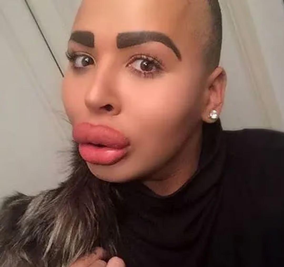 130 bin sterlinlik estetikleriyle g&uuml;ndem olmuştu! &Uuml;nl&uuml; fenomen hayatını kaybetti 2