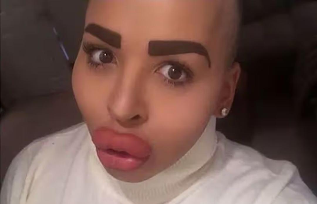 130 bin sterlinlik estetikleriyle g&uuml;ndem olmuştu! &Uuml;nl&uuml; fenomen hayatını kaybetti 1