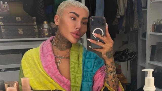 130 bin sterlinlik estetikleriyle gündem olmuştu! Ünlü fenomen hayatını kaybetti