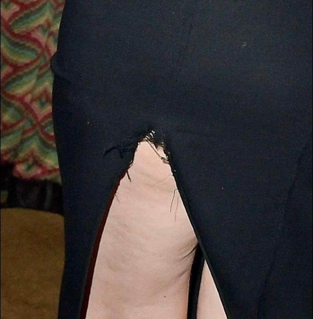 Şıklığı Olaydı&hellip; Eteği yırtılınca geceye damga vurdu! 3