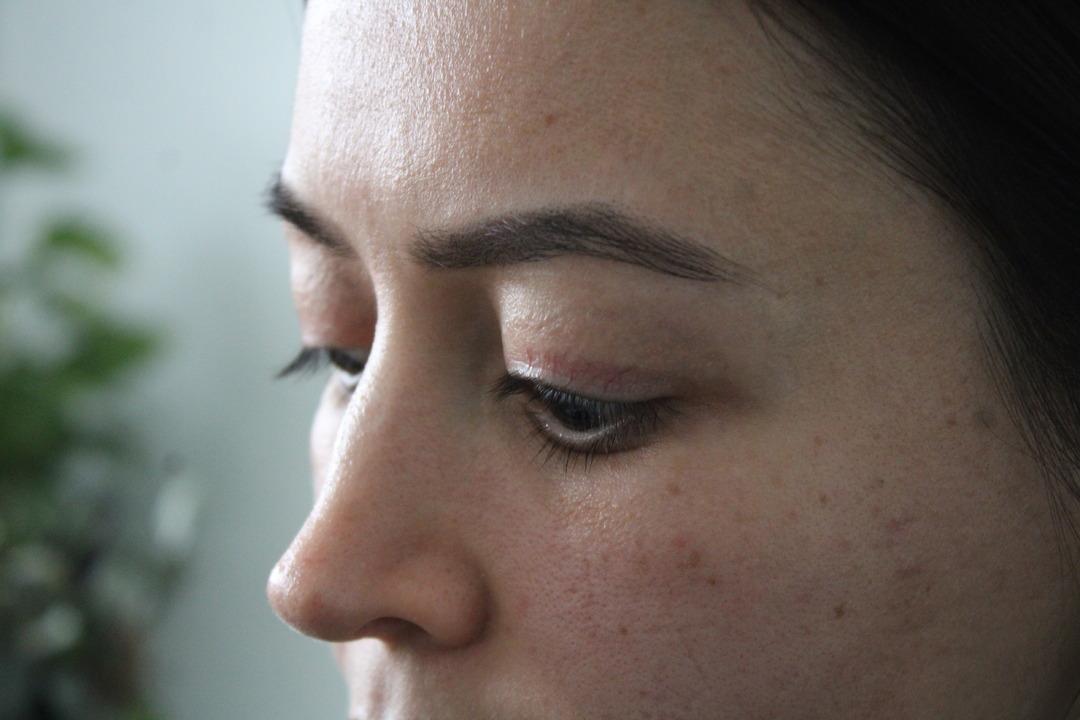 G&uuml;zellik salonunda 1000 liralık işlem yaptırdı: G&ouml;z&uuml;nde kalıcı hasar oluştu! 3