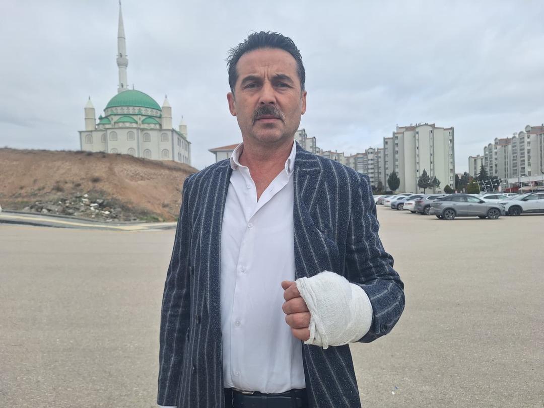 Trafik tartışmasında kaputta s&uuml;r&uuml;klendi: D&uuml;şs&uuml;n diye zikzak &ccedil;izdi 3