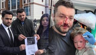 14 aylık bebeğin yaralandığı saldırıda pes dedirten ifade