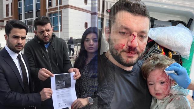 Yalova'da 14 aylık bebeğin yaralandığı saldırıda pes dedirten savunma: Amacım babasına vurmaktı, fırlattığım cisim...