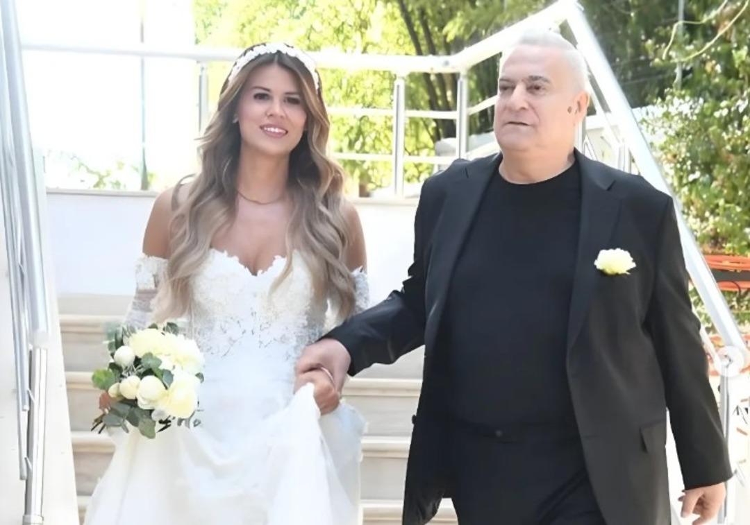 Mehmet Ali Erbil ile boşanmasının ardından değişime başladı! G&uuml;lseren Ceylan dolgularını eritti 1