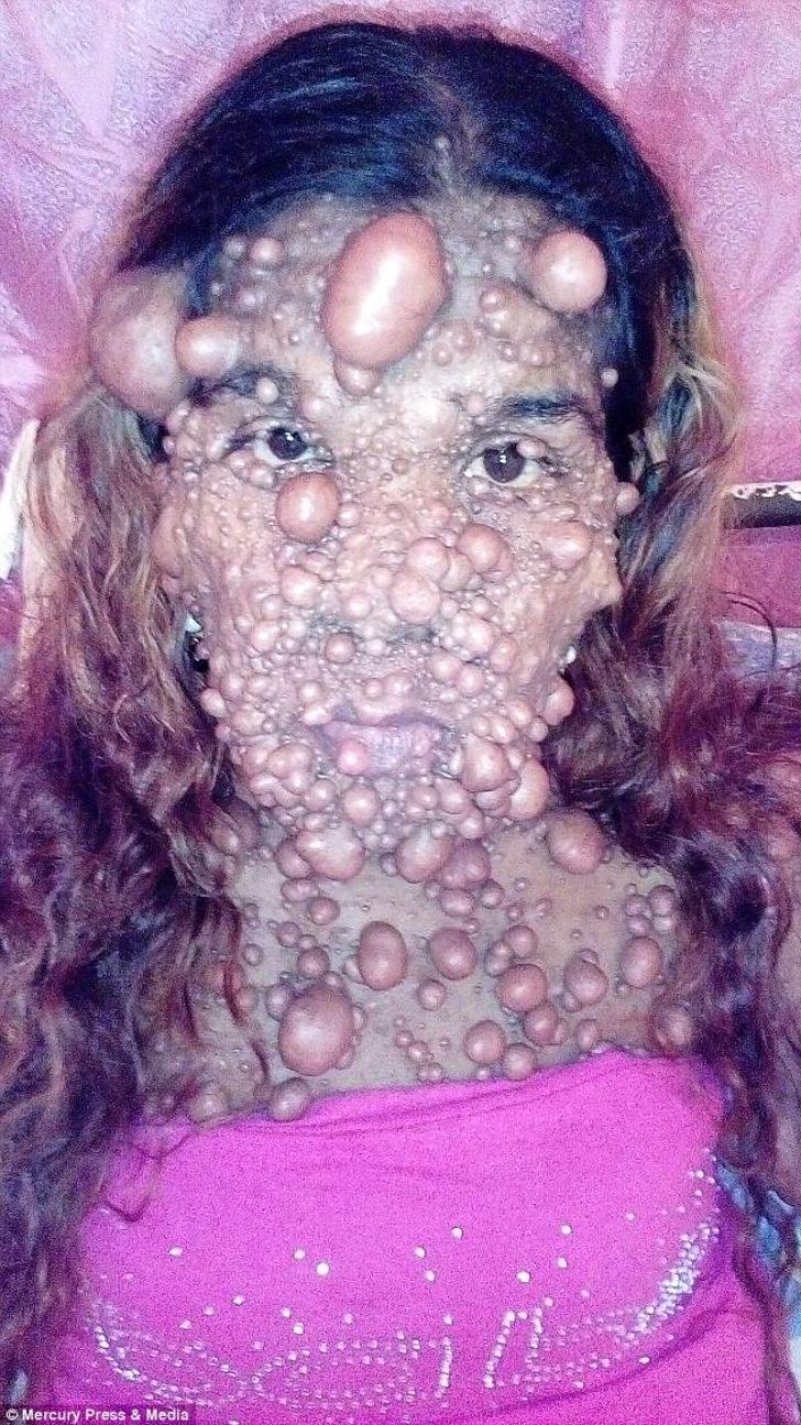 Hastalığı yüzünden tanınmaz hale geldi! Sadece kafasında 3 binden fazla tümör var G1