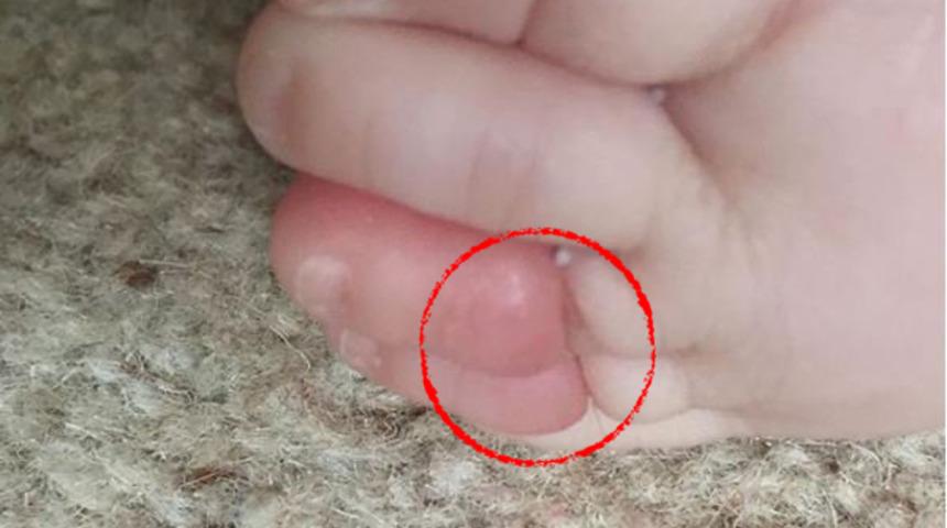 Annesinin sa&ccedil;ı az daha parmağından edecekti