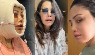 Kore'de y&uuml;z nakli yaptırmıştı! Didem Ceran 'Saklamak istemiyorum' diyerek hastalığını a&ccedil;ıkladı